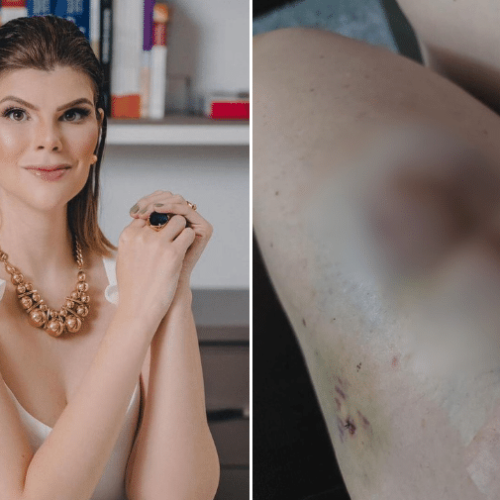 Médica do Paraná se torna ré por dar falsos diagnósticos de câncer de pele e recomendar cirurgias desnecessárias
